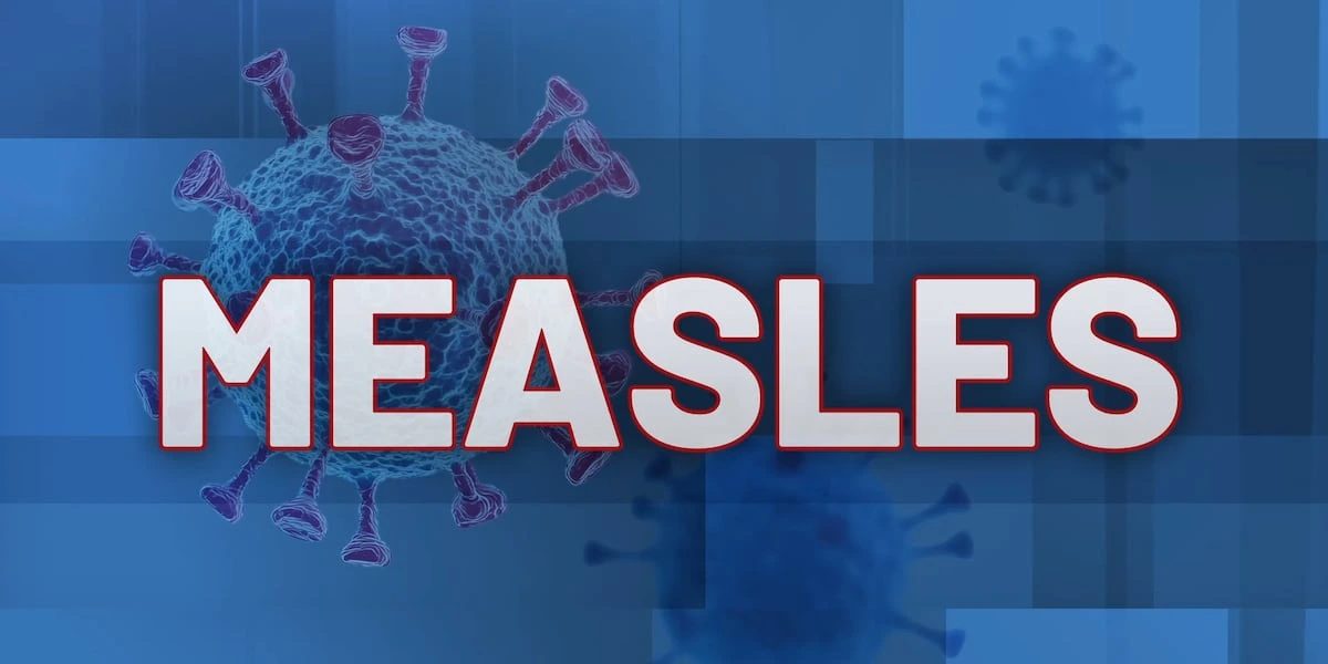 measles